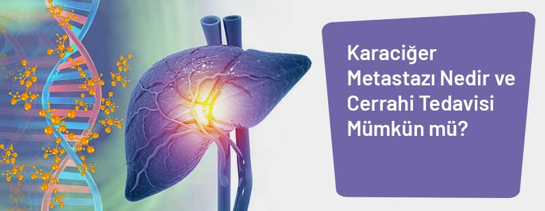 Karaciğer Metastazı Nedir? Cerrahi Tedavisi Mümkün mü?