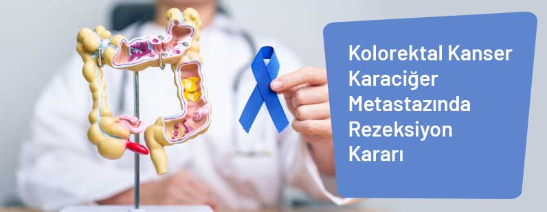 Kolorektal Kanser Karaciğer Metastazında Rezeksiyon Kararı
