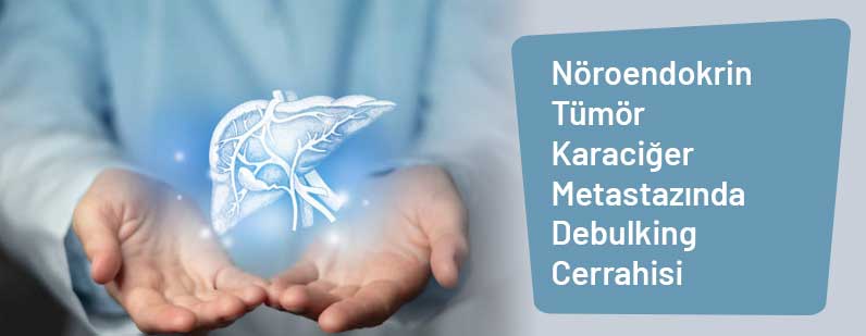 Nöroendokrin Tümör Karaciğer Metastazında Debulking Cerrahisi