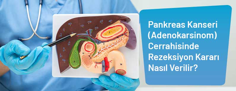 Pankreas Kanseri Cerrahisinde Rezeksiyon Kararı Nasıl Verilir?