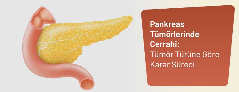 Pankreas Tümörlerinde Cerrahi: Tümör Türüne Göre Karar