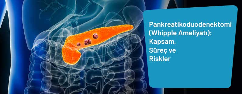 Pankreatikoduodenektomi (Whipple Ameliyatı): Kapsam, Süreç ve Riskler